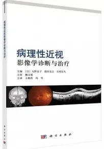 病理性近视影像学诊断与治疗