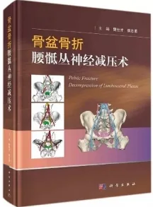 骨盆骨折腰骶丛神经减压术
