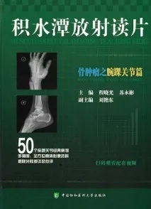 积水潭放射读片 骨肿瘤之腕踝关节篇