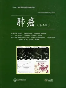 肺癌 第2版