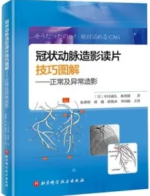 冠状动脉造影读片技巧图解 正常及异常造影