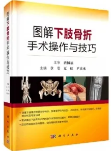 图解下肢骨折手术操作与技巧