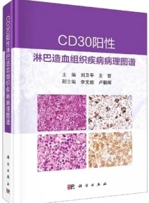 CD30阳性淋巴造血组织疾病病理图谱
