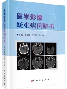 医学影像疑难病例解析