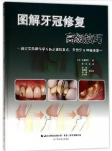 图解牙冠修复高级技巧
