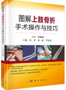 图解上肢骨折手术操作与技巧