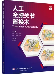 人工全膝关节置换术
