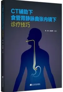 CT辅助下食管胃静脉曲张内镜下诊疗技巧