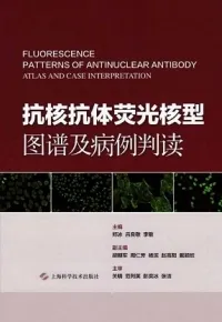 抗核抗体荧光核型图谱及病例判读
