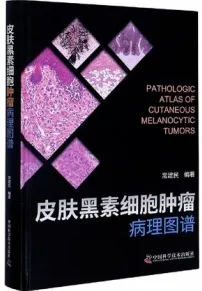 皮肤黑素细胞肿瘤病理图谱
