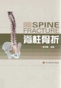 脊柱骨折