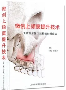 微创上颌窦提升技术 上颌后牙区口腔种植创新疗法