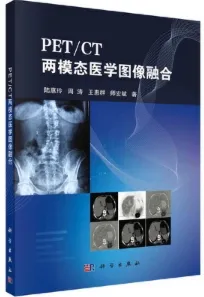PET CT两模态医学图像融合