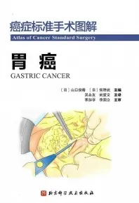 癌症标准手术图解 胃癌