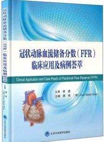 冠状动脉血流储备分数FFR临床应用及病例荟萃