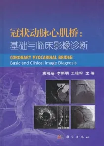 冠状动脉心肌桥 基础与临床影像诊断
