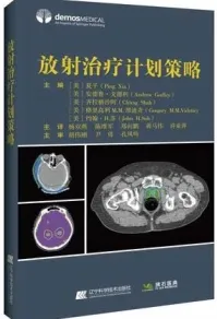 放射治疗计划策略
