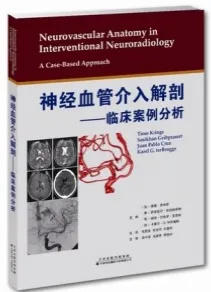神经血管介入解剖 临床案例分析