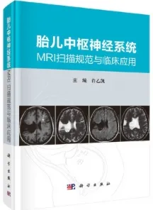 胎儿中枢神经系统MRI扫描规范与临床应用