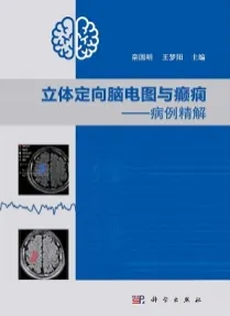 立体定向脑电图与癫痫 病例精解