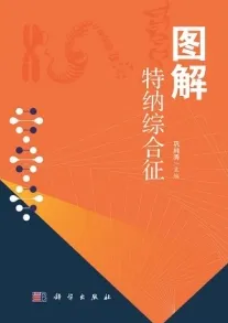 图解特纳综合征