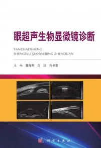 眼超声生物显微镜诊断