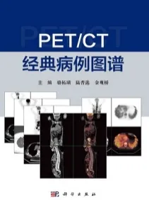 PET CT经典病例图谱