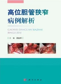 高位胆管狭窄病例解析