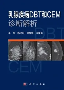 乳腺疾病DBT和CEM诊断解析