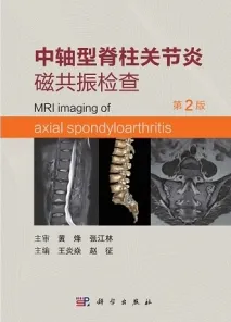 中轴型脊柱关节炎磁共振检查（第2版）