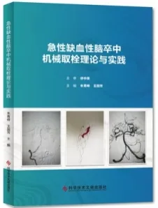 急性缺血性脑卒中机械取栓理论与实践