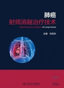 肺癌射频消融治疗技术