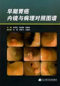 早期胃癌内镜与病理对照图谱