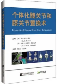 个体化髋关节和膝关节置换术