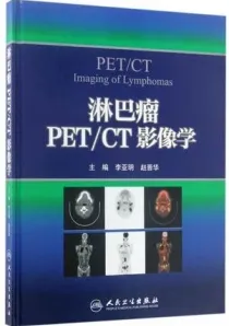 淋巴瘤PET CT影像学