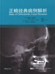 正畸经典病例解析