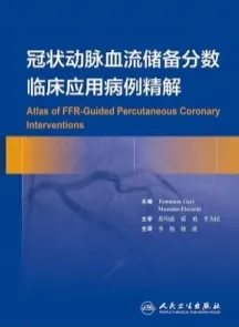 冠状动脉血流储备分数临床应用病例精解