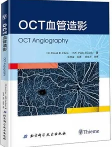 OCT血管造影