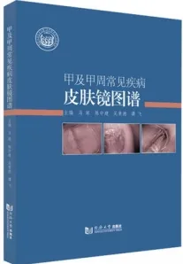 甲及甲周常见疾病皮肤镜图谱