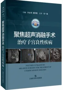 聚焦超声消融手术治疗子宫良性疾病