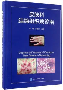 皮肤科结缔组织病诊治