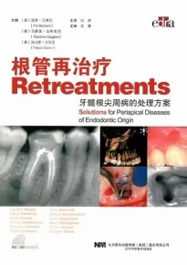 根管再治疗 牙髓根尖周病的处理方案