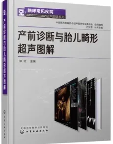 产前诊断与胎儿畸形超声图解
