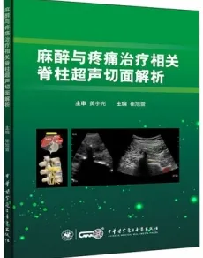 麻醉与疼痛治疗相关脊柱超声切面解析