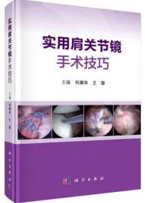 实用肩关节镜手术技巧