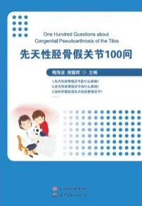 先天性胫骨假关节100问