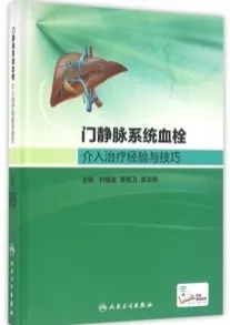门静脉系统血栓介入治疗经验与技巧