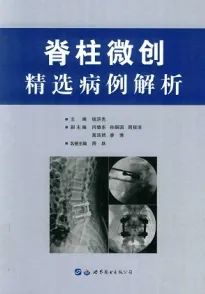 脊柱微创精选病例解析