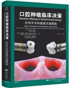 口腔种植临床决策 外科手术和修复方案图集
