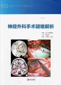 神经外科手术疑难解析